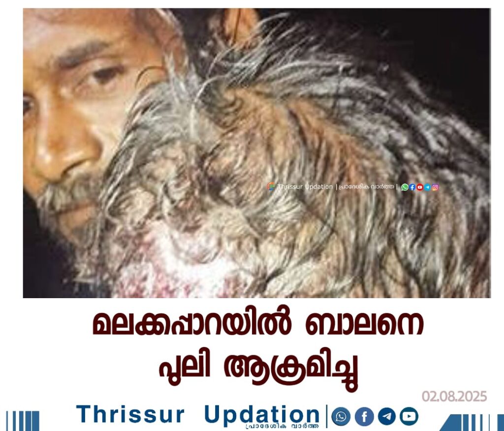 മലക്കപ്പാറയിൽ&nbsp; ബാലനെ പുലി ആക്രമിച്ചു